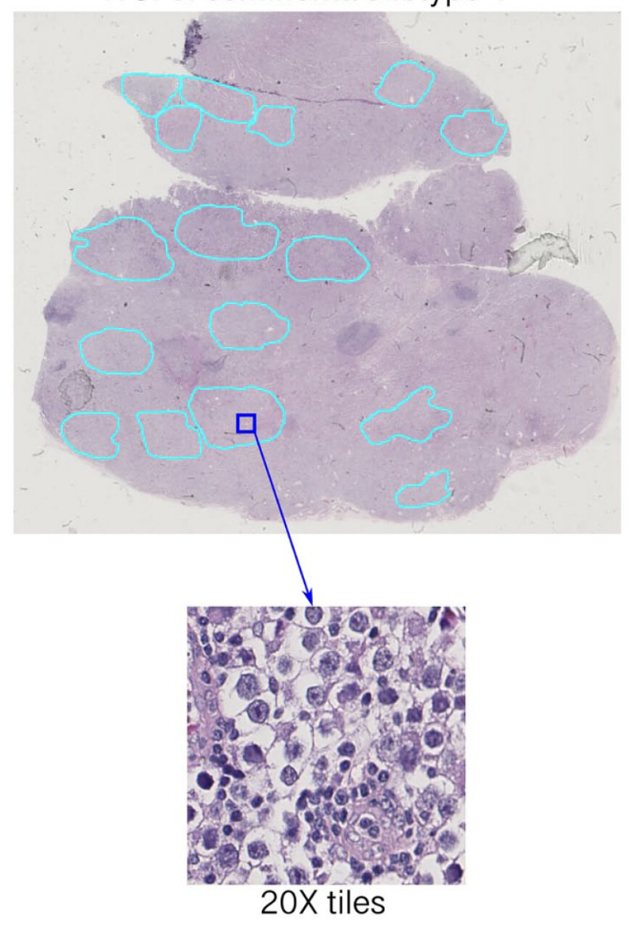 identification of seminoma subtypes using H E slides
